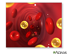 Illustration of cholesterol in the blood