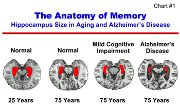 Chart 1: The Anatomy of Memory