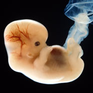 A six week old human embryo