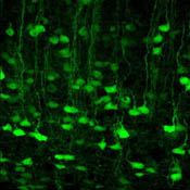 An image of GFP fluorescence in neurons that express the homeobox gene Otx1
