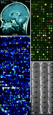 A collection of neuroscience gene discovery images (upper left: imaging of a human brain, upper right and lower left: fluorescent DNA spots from a typical microarray study, lower right: polymerase chain reaction results)