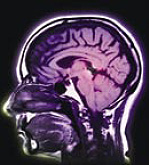 Abstract image of a human head showing the brain