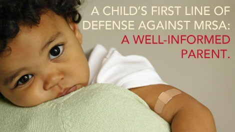 Card shows a photo of a small child with eyes open, on parent’s shoulder, with a band-aid on the child’s arm and reads, “A child’s first line of defense against MRSA: A well-informed parent.” The card opens and reads, “Most staph skin infections, including MRSA, appear as a bump or infected area on the skin that may be: red, swollen, painful, warm to the touch, full of pus or other drainage. If you or someone in your family has these signs, especially with a fever, cover the area with a bandage and call your doctor. For more information, visit www.cdc.gov/MRSA”. Card links to http://www.cdc.gov/MRSA?s_cid=ecard_MRSA