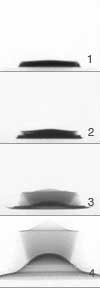 radiograph sequence