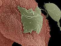An electron micrograph depicts the Trichomonas vaginalis parasite adhering to vaginal epithelial cells collected from vaginal swabs. A non-adhered parasite (right) is pear-shaped, whereas the attached parasite is flat and amoeboid. 