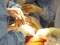 Clinical Perspectives: 7-Year-Old Girl Has 6 Organs Removed