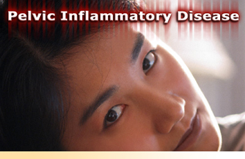 Pelvic Inflammatory Disease