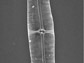 diatom