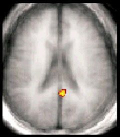 Photo of a fMRI brain scan