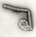 1918 Influenza Virus