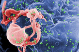 Scanning electron micrograph of HIV emerging from a white blood cell. Green bumps on cell surface are sites of assembly and “budding” of virus particles. 