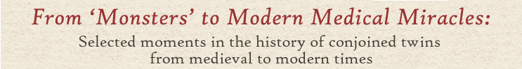 From 'Monsters' to Modern Medical Miracles: Selected moments in the history of conjoined twins from medieval to modern times Home