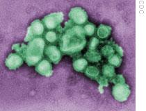 Electron micrograph of swine flu virus