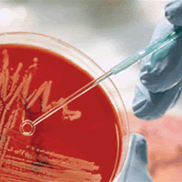 close up of a petri dish being scraped