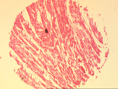 Cardiac Muscle