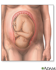 Illustration of a fetus in the womb