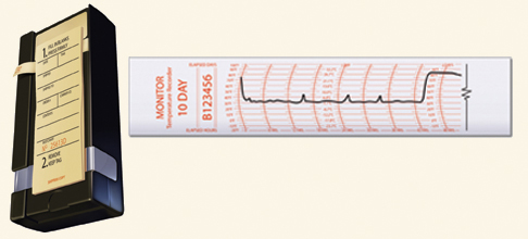 Strip monitors record continuous temperature readings on a paper strip.