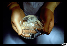Photograph of a gloved pair of hands holding a breast implant