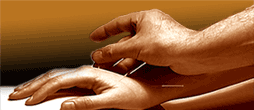 Acupuncturist inserting needle in patient's hand