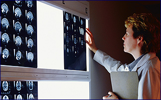 A doctor reviewing a CAT scan