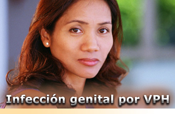 Infección genital por VPH