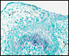 A normal tooth germ in which the p21 protein is expressed in the primary enamel knot