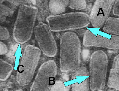 Rabies virus