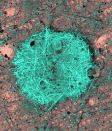 Image of a blue-green fibrous mass.