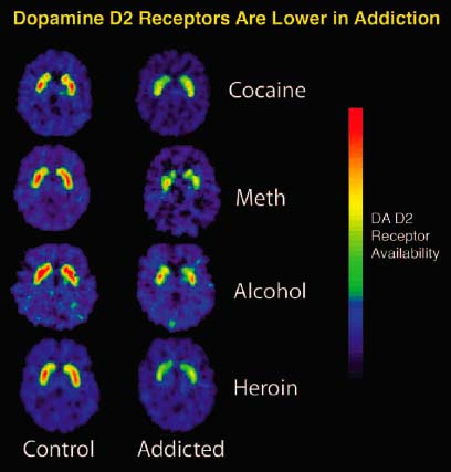 BRAIN IMAGING IS A KEY TOOL IN STUDIES SPONSORED BY THE
DIVISION OF CLINICAL NEUROSCIENCE AND BEHAVIORAL RESEARCH