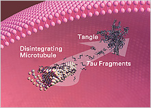 Illustration: disintegrating microtubules shed tau fragments, which form neurofibrillary tangles