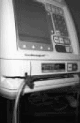 Photograph of an infusion pump with tube clamp to regulate the flow of fluids.