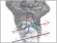 Illustration showing two mechanisms for generating rotation in volcanic plumes.