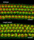 Mutations in a gene called Vangl2 lead to defects in the orientation of hair cell stereociliary bundles.