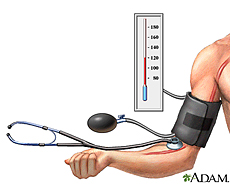 Ilustración de monitoreo de la presión sanguínea