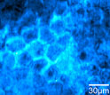 SRS image showing diffusion of retinoic acid