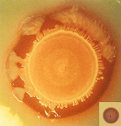 Photo: Large Salmonella colony in a petri dish. Link to photo information