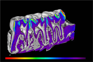 Image: tooth scan