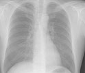 image of chest x-ray