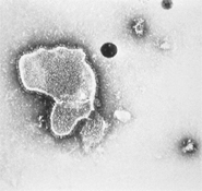 electron micrograph respiratory syncytial virus 