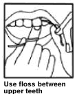 Flossing between upper teeth
