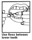 Flossing between lower teeth