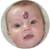 Babies with Birthmarks