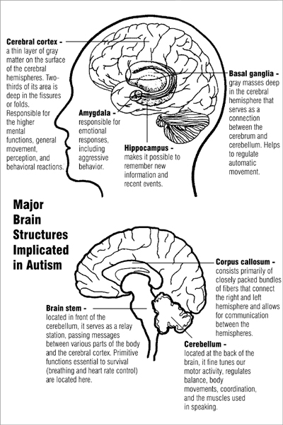 Major brain structures implicated in autism