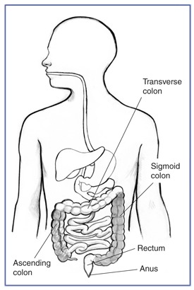 Drawing of the gastrointestinal tract with labels pointing to the ascending colon, transverse colon, sigmoid colon, rectum, and anus. The ascending colon and the sigmoid colon are shaded.