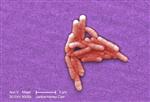 Under a moderately-high magnification of 8000X, this colorized scanning electron micrograph (SEM) revealed the presence of a small grouping of Gram-negative Salmonella typhimurium bacteria that had been isolated from a pure culture. REUTERS/CDC/Handout