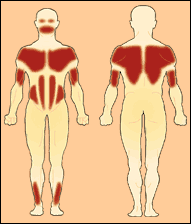 En la FSHD, músculos más afectados.