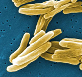 Scanning electron micrograph (SEM) image of Mycobacterium tuberculosis bacteria.
