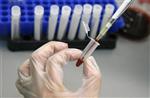 A laboratory technician examines blood samples for HIV/AIDS in a public hospital in Valparaiso city, about 75 miles (120 km) northwest of Santiago, November 14, 2008. REUTERS/Eliseo Fernandez