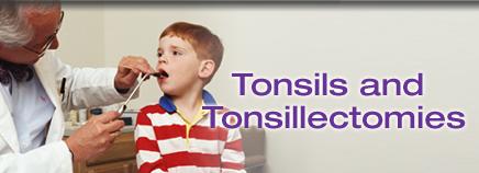 Tonsils and Tonsillectomies