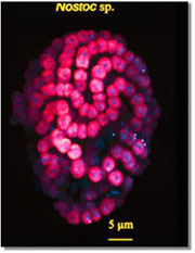 Laser confocal photomicrograph